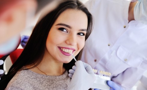 Woman's smile compared to cosmetic dental bonding shade chart