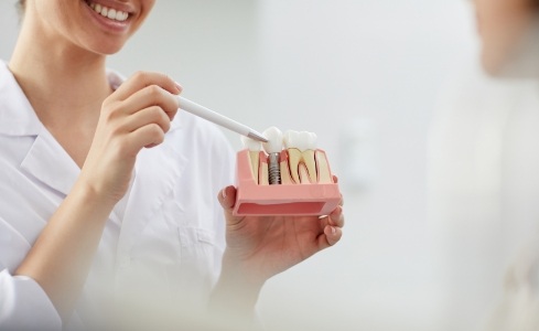 Dentist and dental patient discussing dental implants