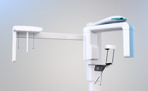 3 D C T cone beam digital x-ray scanner