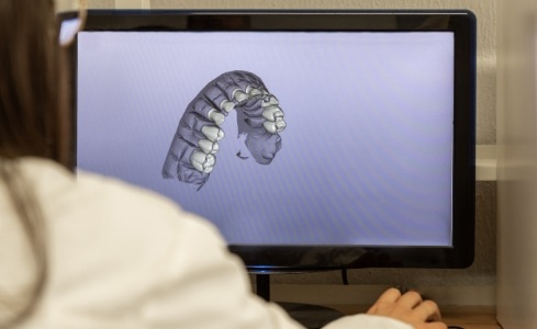 Dentist using digital impression system