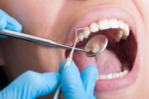 a patient attending their oral cancer screening